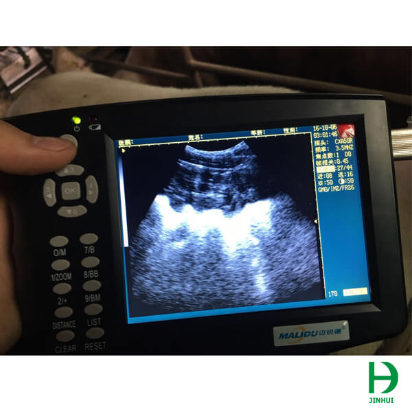 ultrasound machine portable